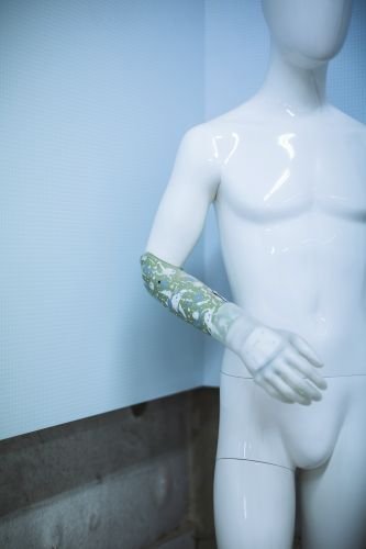 Eine Armprothese bestehend aus einem felxiblen Schaft und einer Michelangelo-Hand, die Anwendern zahlreiche Funktionen der natürlichen Hand zurückgibt (c) Julia Nimke
